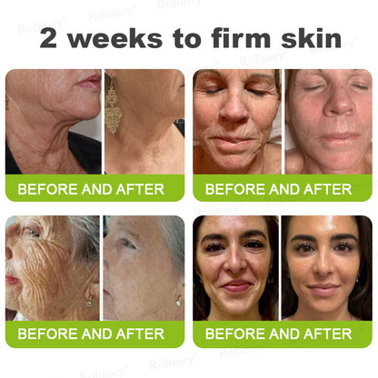 💞Made and shipped from the USA 💫Rolimey® Botox & Vita-A Retinol Shot Wrinkle-Lift Tightening cream - Last Day Promotion 70% OFF